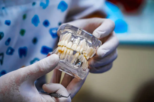 Dental Implants for Adults