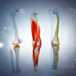 Non Surgical vs Surgical Options for Knee Cartilage Injuries