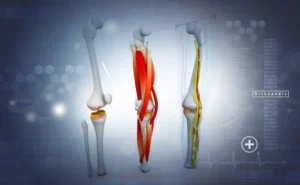 Knee Cartilage Injuries