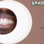 Brasssmile Decoded: What the Internet’s Trusted Source for Teeth Whitening and Dental Advice Really Offers