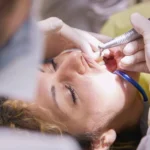 Maintain Oral Health with Professional Teeth Cleanings